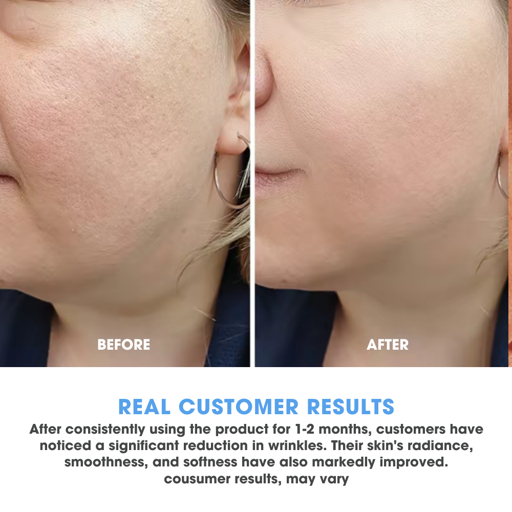 3% Hyaluronic Acid Serum — 1.2 ml Vials